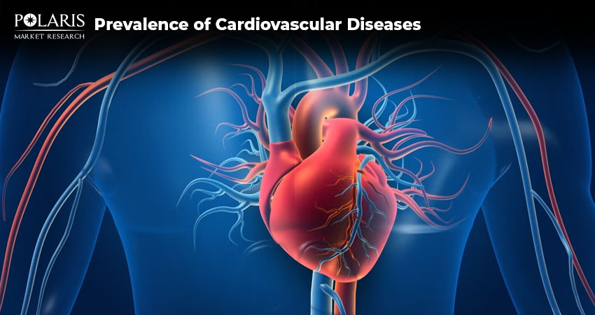 Growing Prevalence of Cardiovascular Diseases to Drive Growth